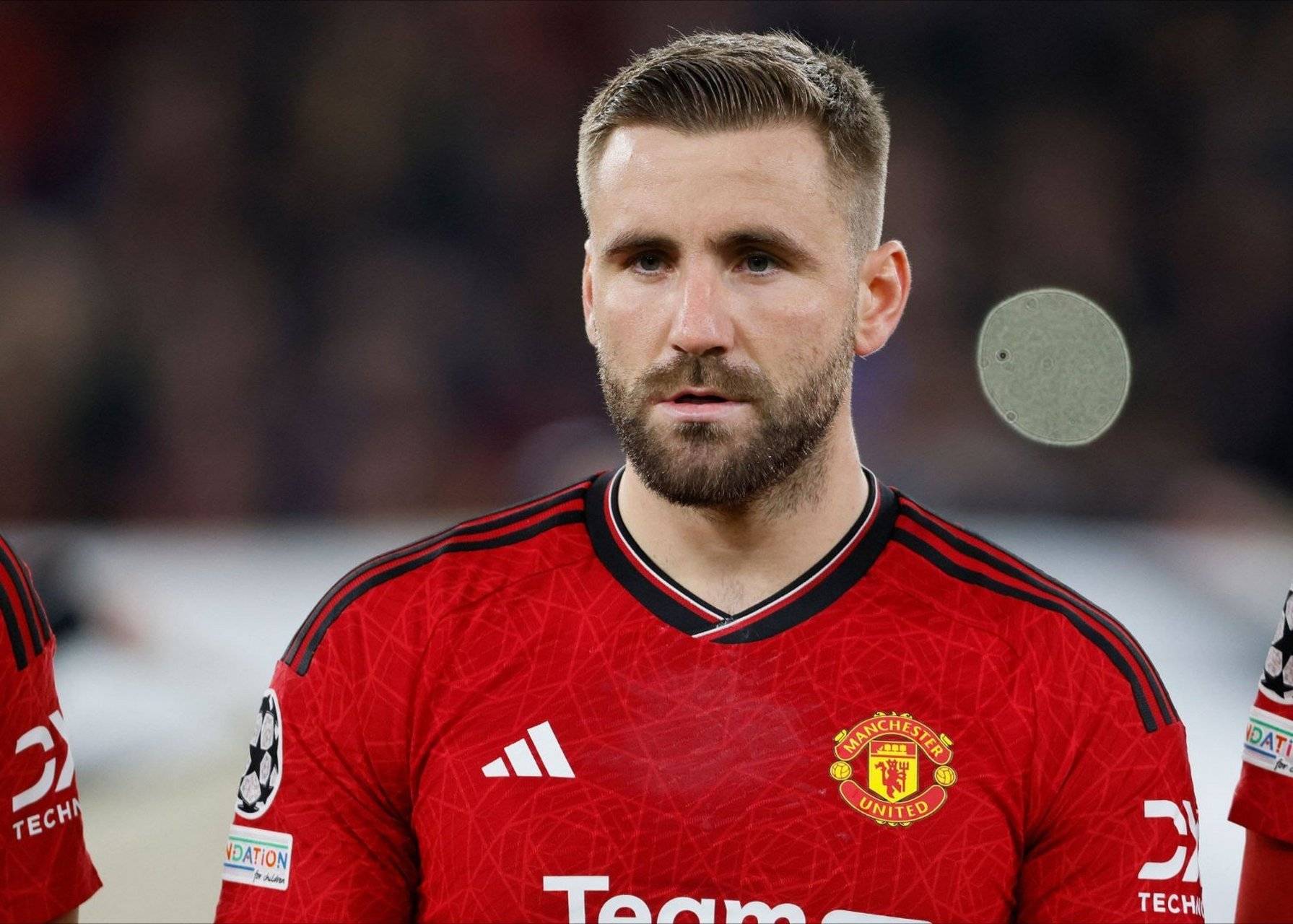 爱游戏平台-电竞国家队在比赛中受伤退赛，曼联主帅表示担忧(电竞 国家队 2018)